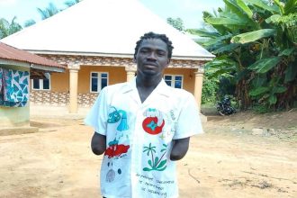 Ebonyi Man Loses Both Arms While Trying to Help Friend Save Shop from Demolition